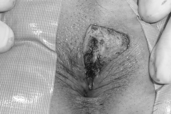 photo2