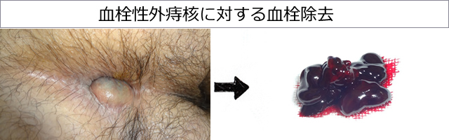 photo2