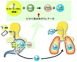 針筋電図検査